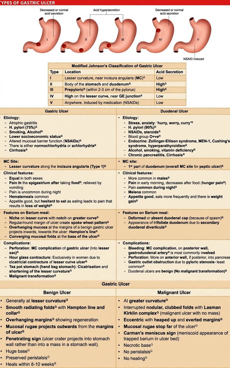 DrJStewart_GS's tweet photo. Gastric vs Duodenal Ulcer - The Surgical High-Yields🩺

🔴 GASTRIC: Barrier failure. Pain AFTER food → fear to eat → WEIGHT LOSS 📉. Biopsy ALWAYS ⚠️- can be malignant.
🟢 DUODENAL: Acid hypersecretion. Hunger pain at night🌙, RELIEVED by food → weight GAIN 📈.Never malignant. https://t.co/zPzbGp7iEn