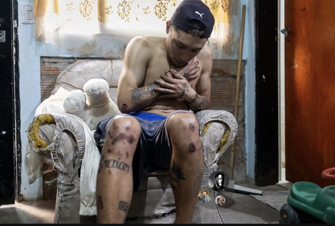 NelSantacruz's tweet photo. Él es Leo, un pibe q está en consumo. Lo desmayaron a golpes decenas de policías en la Villa 31. Lo llevaron de pies y manos hasta el destacamento para despertarlo con agua. Lo arrastraron x todos lados, le fracturaron costillas y codo. Tormenta Negra se llama.Fotos: Nico Suárez. https://t.co/aFgMSkfjdC