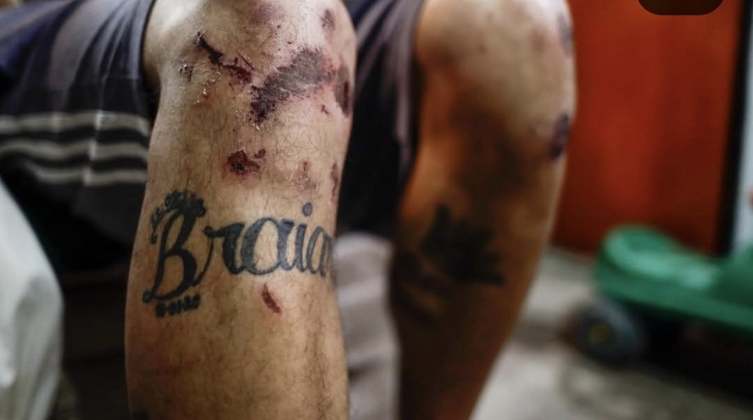 NelSantacruz's tweet photo. Él es Leo, un pibe q está en consumo. Lo desmayaron a golpes decenas de policías en la Villa 31. Lo llevaron de pies y manos hasta el destacamento para despertarlo con agua. Lo arrastraron x todos lados, le fracturaron costillas y codo. Tormenta Negra se llama.Fotos: Nico Suárez. https://t.co/aFgMSkfjdC
