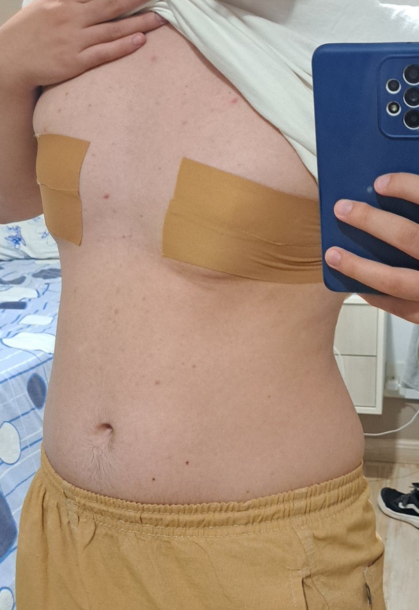 transmascporn's tweet photo. my first time using a trans tape https://t.co/6VcoIVVgbP