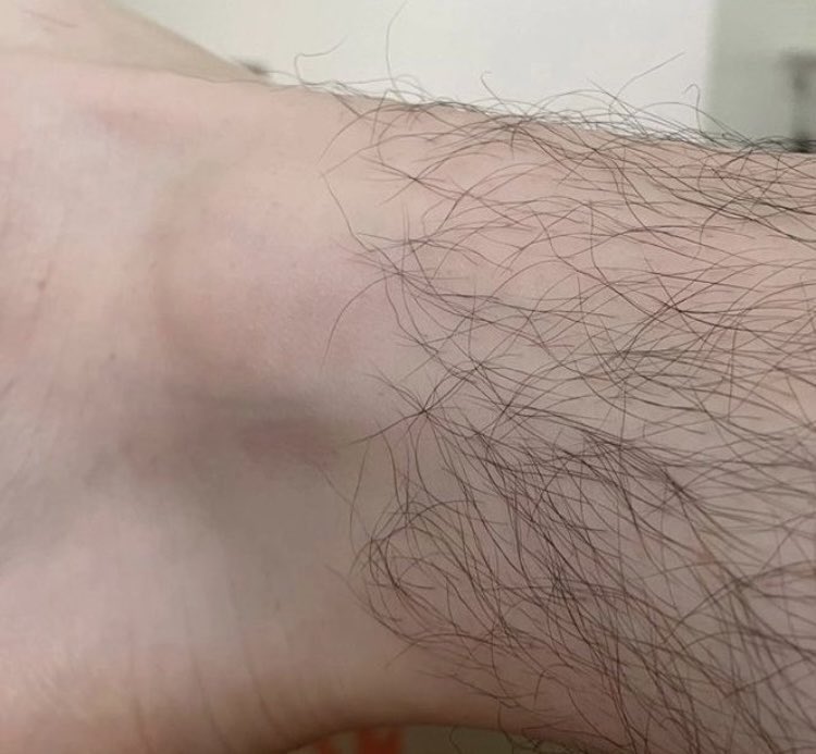 rsmemes_oficial's tweet photo. Tão engraçado que os pelos da perna eles simplesmente falam: 
"Ok, tá bom até aqui" e param crescer https://t.co/Q83E5dtH6X