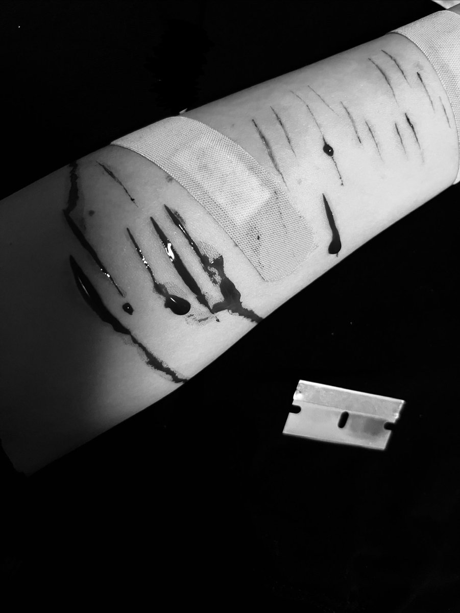 savouredsex's tweet photo. Fake halloween sfx makeup

Christ I kinda fucksd up #shrtwt https://t.co/FePWL3KkOJ