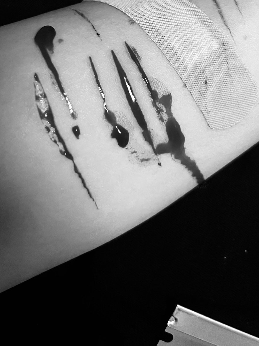 savouredsex's tweet photo. Fake halloween sfx makeup

Christ I kinda fucksd up #shrtwt https://t.co/FePWL3KkOJ