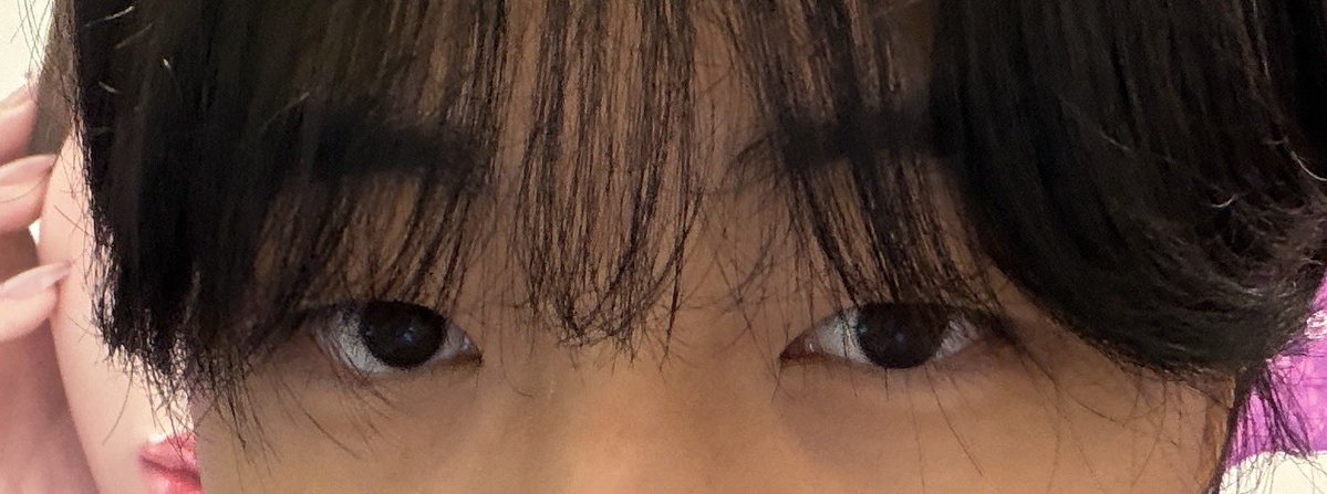 DeathChurros's tweet photo. 自然癒着法（挙筋法）
99000円（モニター）
3ヶ月幅変更可能・5年保証は神❣️

左から整形前、直後、1日目です‼️

#整形垢さんと繋がりたい
#美容垢さんと繋がりたい https://t.co/iTrkeW8xmM