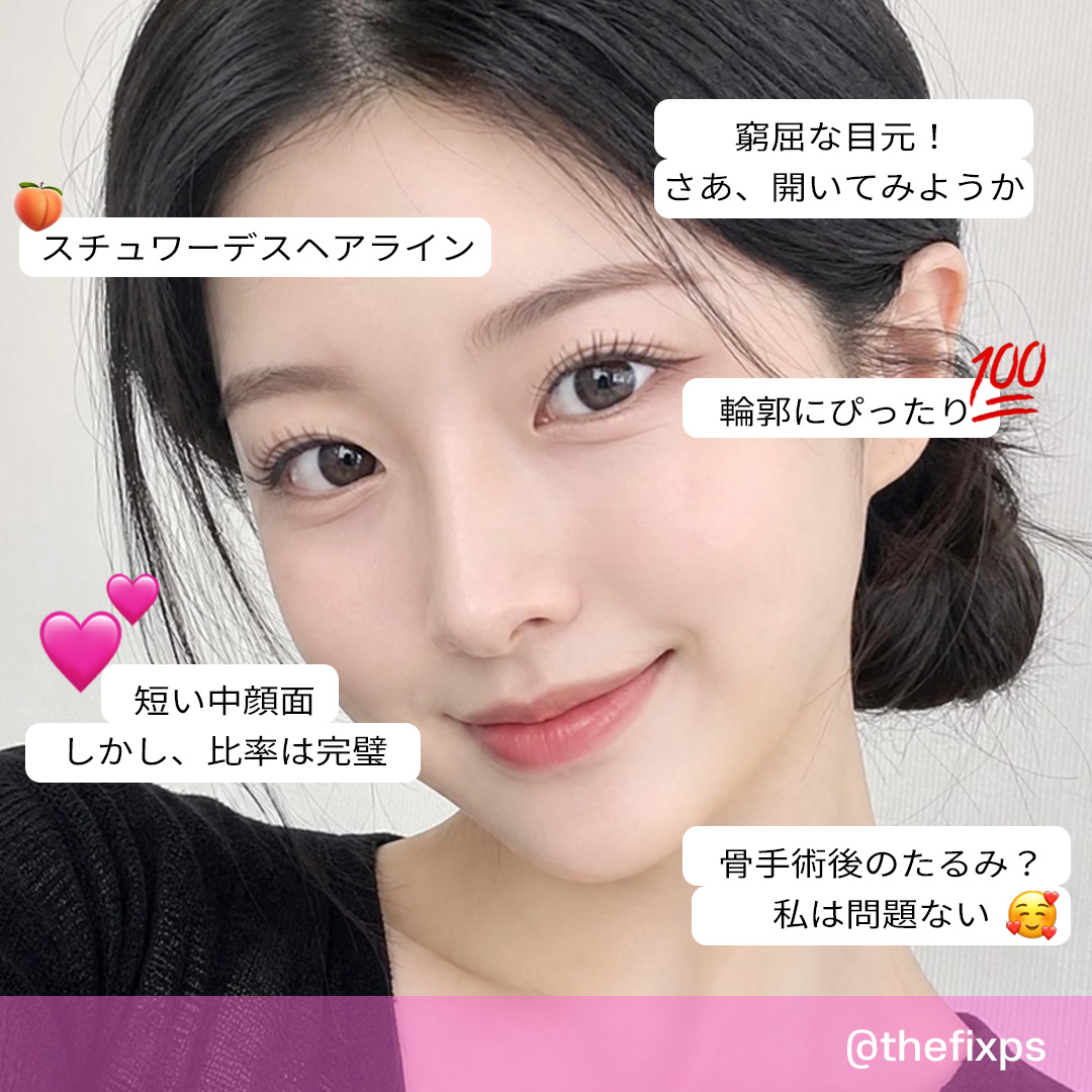 choedonghu43570's tweet photo. 挙上専門病院ザ·フィックス😍額の手術も顔面の手術も、ザ·フィックスと一緒なら心配いりません~! 信頼に基づいた手術方法とノウハウで満足度を高め、几帳面な縫合を通じて日常生活への復帰が早いです📷お問い合わせは ラインの ID: thefix_jp https://t.co/6MnAHyln8a