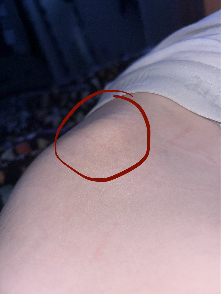luv_wxunds's tweet photo. would i hit anything serious or injur myself badly if i were to cut to styro right here (hip bone) https://t.co/zzO7X5C7Ez