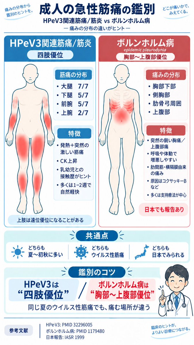 KamedaRheukdop's tweet photo. 【Rheumatology TIPS】
Parechovirus V3（HPeV3）関連筋痛／筋炎

夏のウィルス性筋炎・筋痛ならばボルンホルム病が有名ですが、同じく夏のウィルス性筋炎でHPeV3も知っておきたい。

両者とも夏〜初秋にみられますが、痛みの分布がヒントになります。

ボルンホルム病
→ 胸部〜上腹部優位
胸部下部、側胸部、肋骨弓周囲の鋭い痛み

HPeV3→ 四肢優位
→ 四肢優位
大腿 ・下腿・前腕の症状頻度が高い

HPeV3では
・発熱
・突然の激しい筋痛
・筋力低下
・CK上昇
を伴うことが多い。

CK上昇は1000以上となる場合もあり、大腿など炎症性筋疾患の罹患部位と似る部分があるため鑑別でも重要となります。

「夏＋急激な筋痛＋CK上昇」をみたら、
自己免疫性筋炎だけでなくHPeV3も鑑別に。
PMID: 32296005