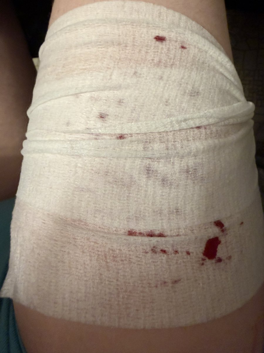 Mmistylake's tweet photo. My sfx makeup and bandage job wow nice all ai no self harm ai generated #shtwt #shedtwt https://t.co/qnzvcLOkFf