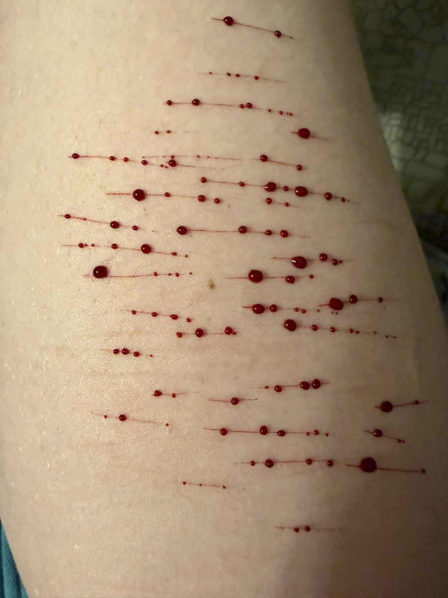 Mmistylake's tweet photo. My sfx makeup and bandage job wow nice all ai no self harm ai generated #shtwt #shedtwt https://t.co/qnzvcLOkFf