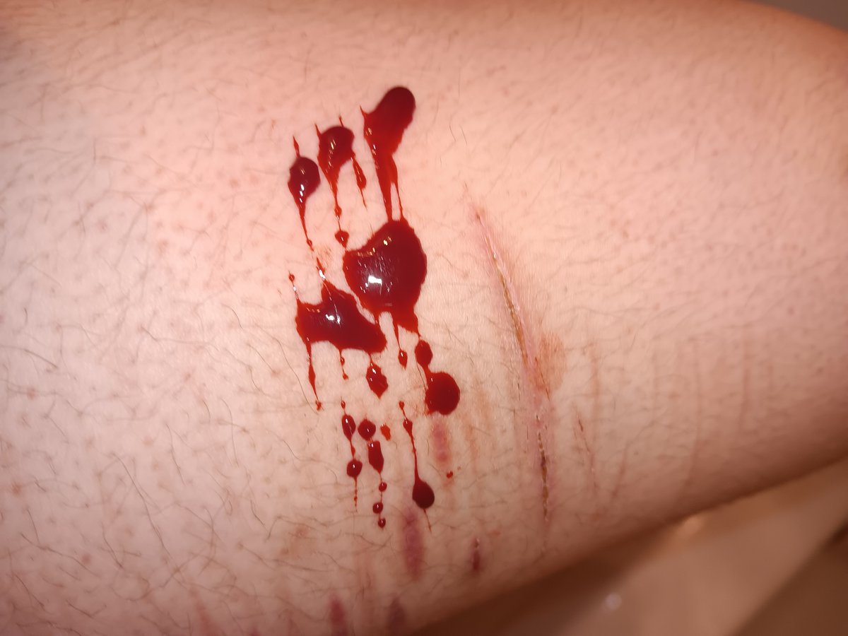 Tacoma790's tweet photo. Block dont report https://t.co/47zwyaUyMy