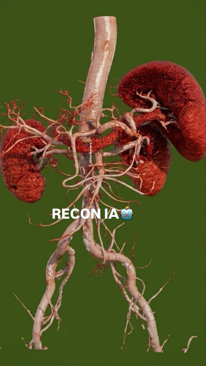 FlavioJrPROMO's tweet photo. Um Comparativo: 

🎮☢️🩻👾🤓😎💡🇧🇷✅

1️⃣ Renderização Original (CT): 

2️⃣ Cópia e Ajuste por IA: 

3️⃣ Identificação Anatômica Guiada:

4️⃣ IA Macroscópica: https://t.co/1O1Edcy0Mh