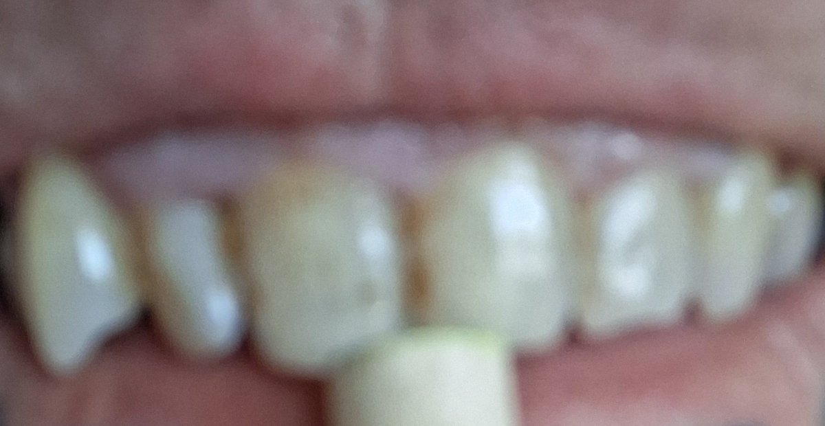 XYZABtb's tweet photo. @AP Let me match the value of these megaindustrial project reports to my family's (pitifully small, by comparison) neighborhood: 

My teeth are collecting proof of Great Value instant coffee purchase. $8.88 worth, per screen, at minimum. https://t.co/wbSeSX52ry