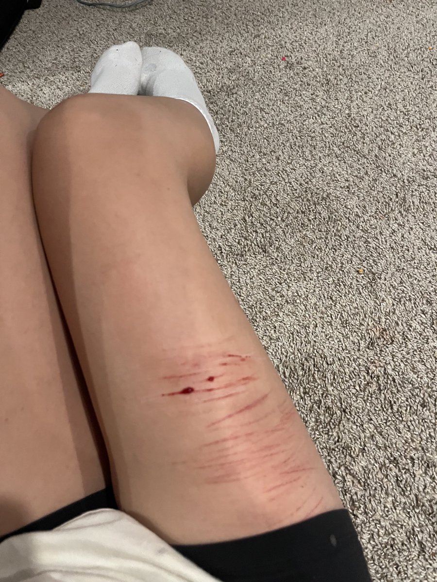 cici65789's tweet photo. Omg I love doing Halloween makeup it’s so realistic 🎃 https://t.co/8Gct87I9LL