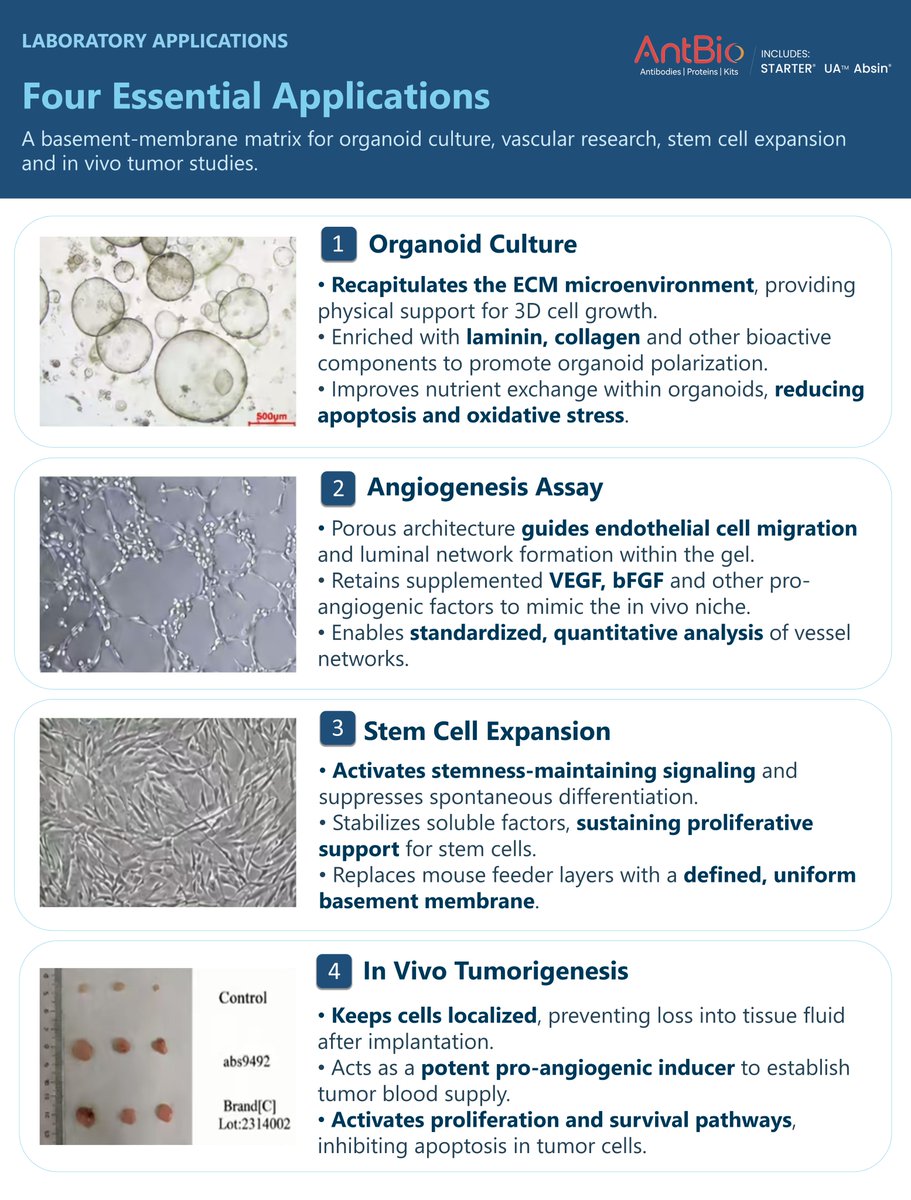 AntBio_'s tweet photo. AntBio OrganoGel for 3D cell culture
▫️Organoid culture
▫️Angiogenesis assays
▫️Stem cell expansion
▫️In vivo tumorigenesis

3 roles: scaffold, biochemical signals, barrier model.
Variants for different experiments.

#OrganoGel #LabReagents #3DCellCulture #AntBio https://t.co/oi5uPrNSu0