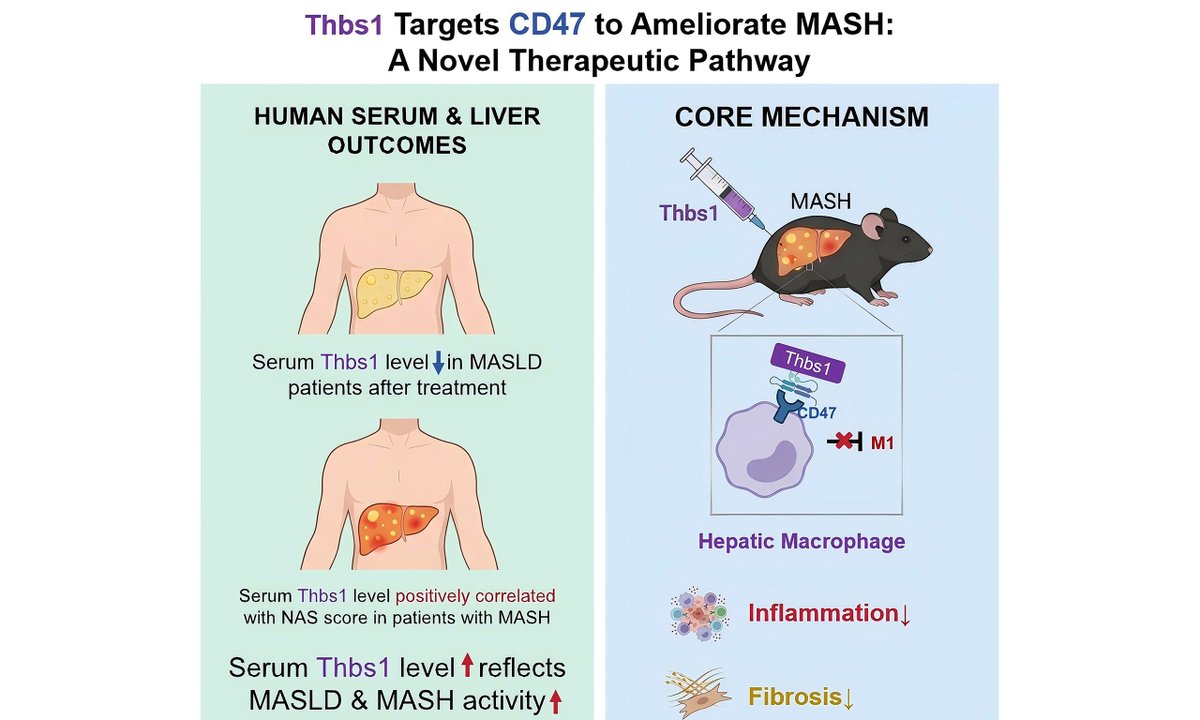 MetabolismAnd's tweet photo. Can the Thbs1–CD47 axis modulate MASH?
This study found that Thbs1 suppressed hepatic macrophage inflammation and early fibrotic features, highlighting the Thbs1–CD47 pathway as a potential therapeutic target.
https://t.co/daoVE6WjOG
#MASH #MASLD #Macrophages #LiverDisease https://t.co/v1VnOFNyzC