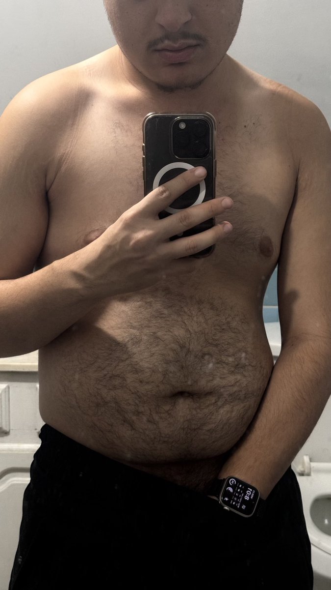 jrsfp's tweet photo. hair or no hair ? #bear https://t.co/xJpop4Kcjx