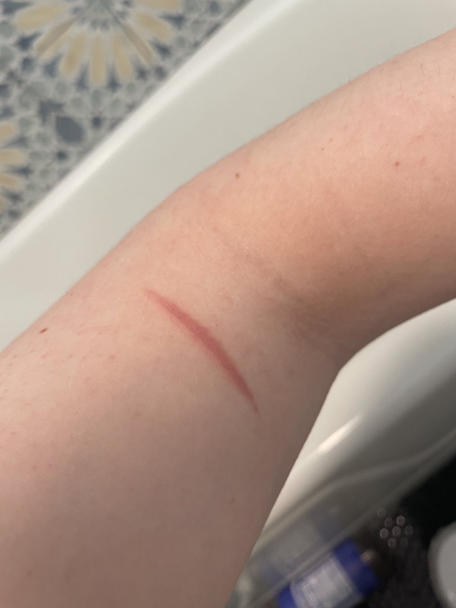 ghostbustingxx's tweet photo. this tiny cat scratch i did to test out my blade healed giant and raised wtf do i do

HEALED SCAR https://t.co/dpfG6tNE1H