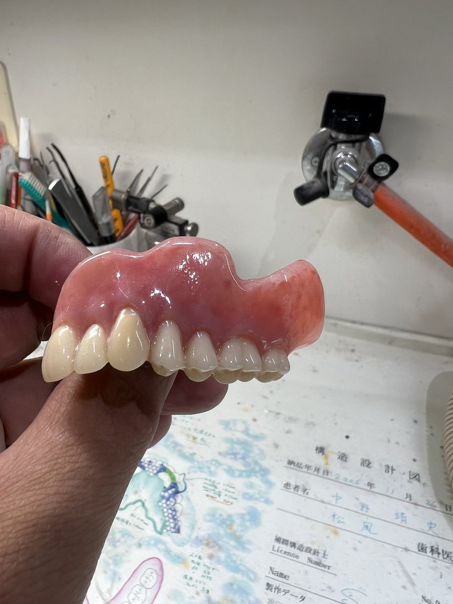 dentaltechnic16's tweet photo. 表面性状なしで仕上げてみた。

のっぺり。 https://t.co/Rl6cwej0Jm