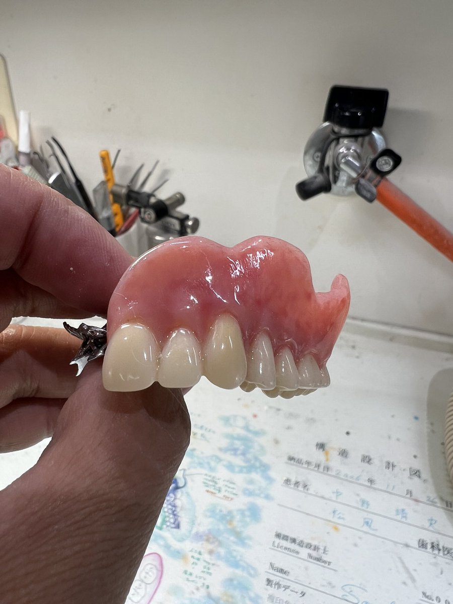 dentaltechnic16's tweet photo. 表面性状なしで仕上げてみた。

のっぺり。 https://t.co/Rl6cwej0Jm