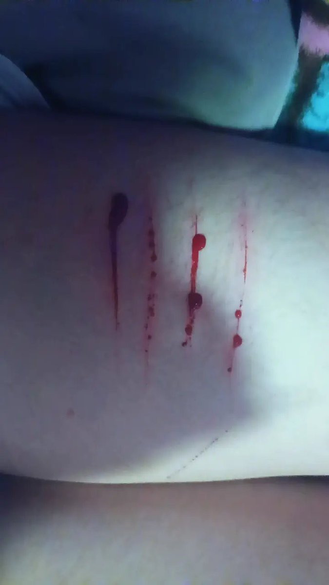 sleepysighs3's tweet photo. Fake makeup, it's just fake wounds, makeup idea for Halloween*wink wink*👀👀 https://t.co/FH1E8k15Aj