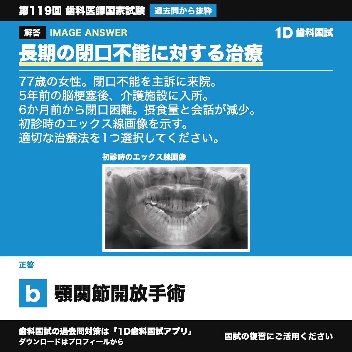 歯科国試Answer 2013 1 歯科国試ANSWER 2026 13巻セット 【公式通販】