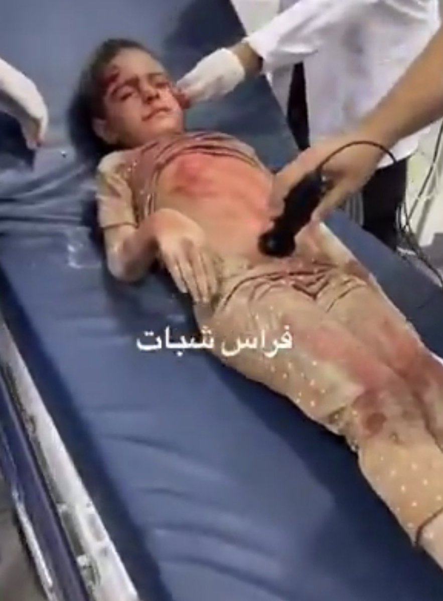 AbujomaaGaza's tweet photo. 💥One person has been killed and four others wounded by Israeli bombing of an apartment in Al Nasr neighbourhood of the Gaza City https://t.co/b8pAASZZhd