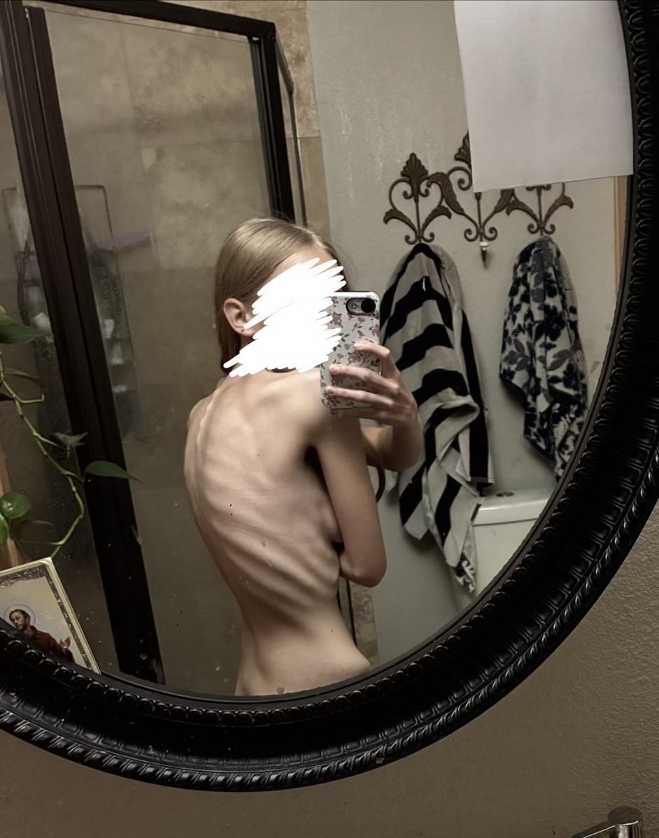 hlterskelter's tweet photo. weighed in @ 37,5kg (82,6lbs) this photo is just so wow bony https://t.co/7H61B6wdgy