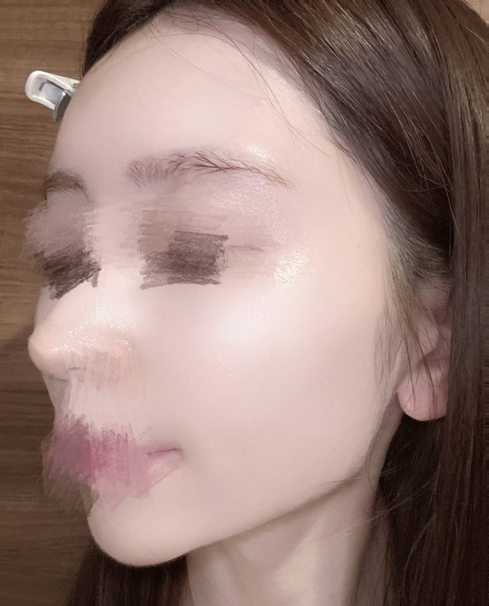 騙されたと思って一回使ってみてほしい。
夜のスキンケアで白玉パックを10分仕込んでから就寝。
翌朝、パッと明るい印象に見えるのが好きすぎる🥹🤍一枚で白玉肌っぽいツヤ感ゲット✨(pr) https://t.co/XqvEohCKFx