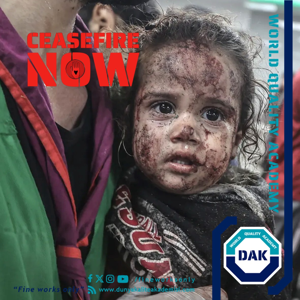 fineworksonly's tweet photo. Vulnerable children continue to be exposed...
https://t.co/VHCPaL4gX3
#DünyaKaliteAkademisi #WorldQualityAcademy #Quality #Academy #Education #iso #Halal #UNHRW #Peace #Children #Justice #ceasefirenow #Gaza #genocide #Wck #OpenArms #Unicef #Amnesty #Msf #Fcnl #Artists4Ceasefire https://t.co/A3FB7X6kHL