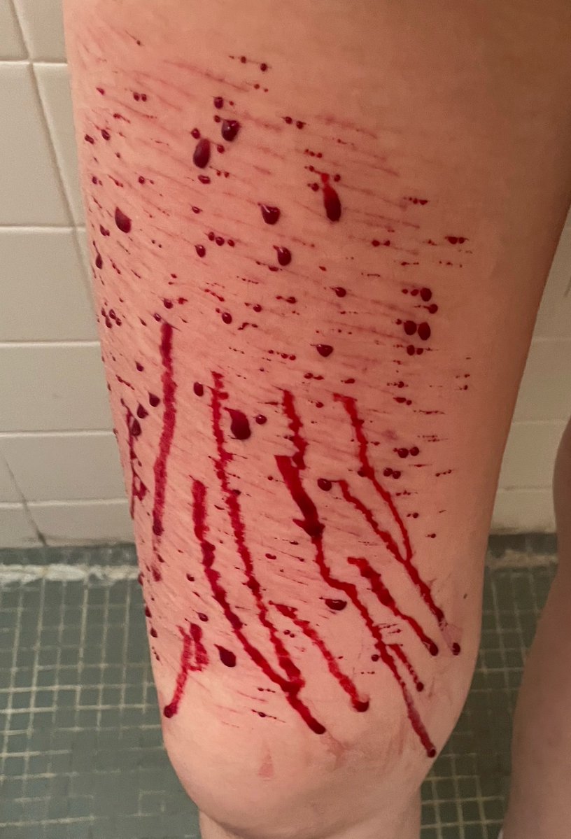 zeroL00hate's tweet photo. today sfx makeup 
these are fake
#sfxmakeup
#makeup
#fake https://t.co/yIKar2BpBX