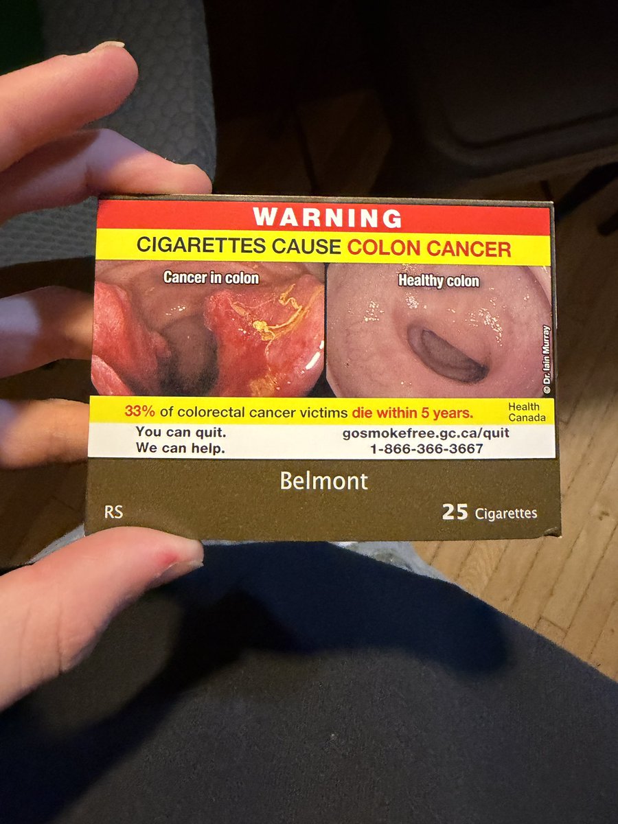 schr04der's tweet photo. yea bro let me stare at someone’s butt hole before i smoke https://t.co/ugEw9lJulQ