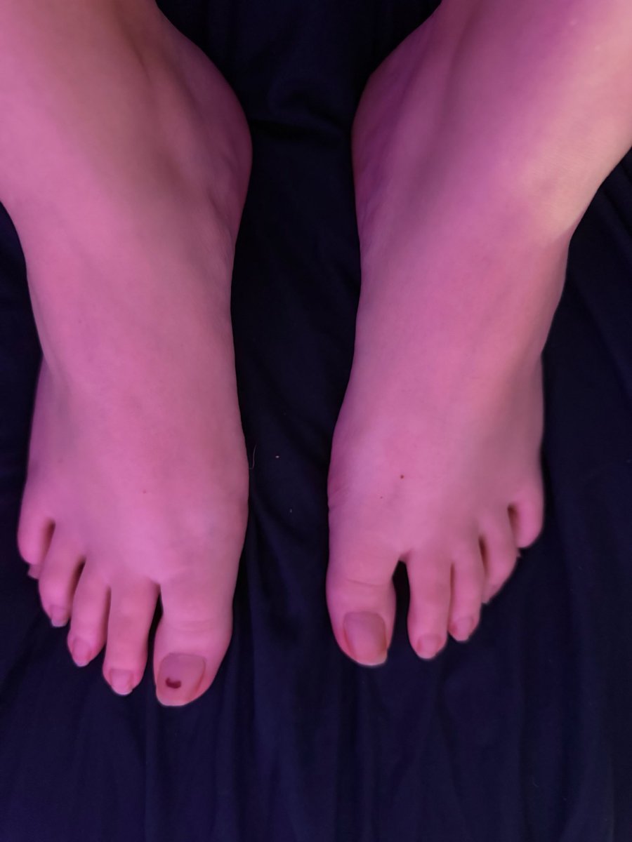 rxckst4rss's tweet photo. quick foot pics before bed ❤️ dm me https://t.co/Z6h7eIDI3x