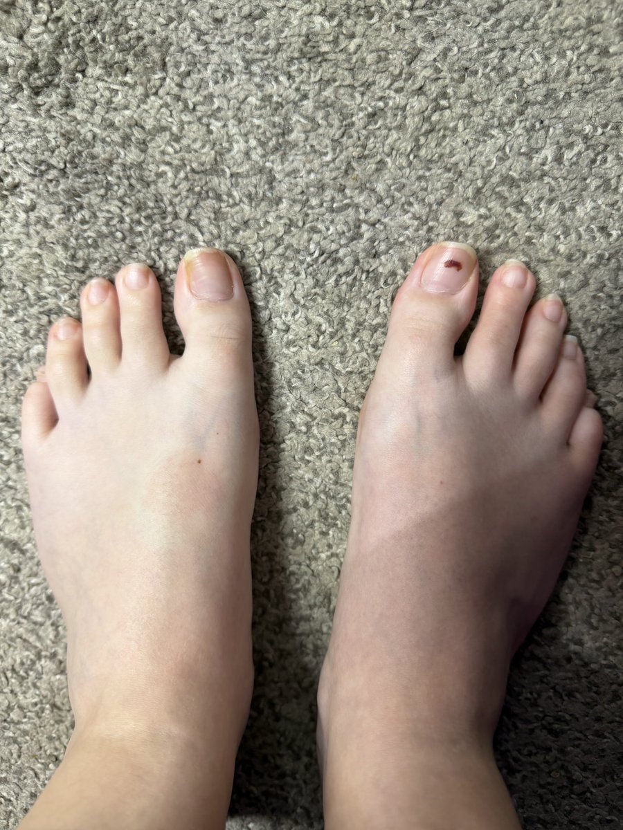 rxckst4rss's tweet photo. quick foot pics before bed ❤️ dm me https://t.co/Z6h7eIDI3x