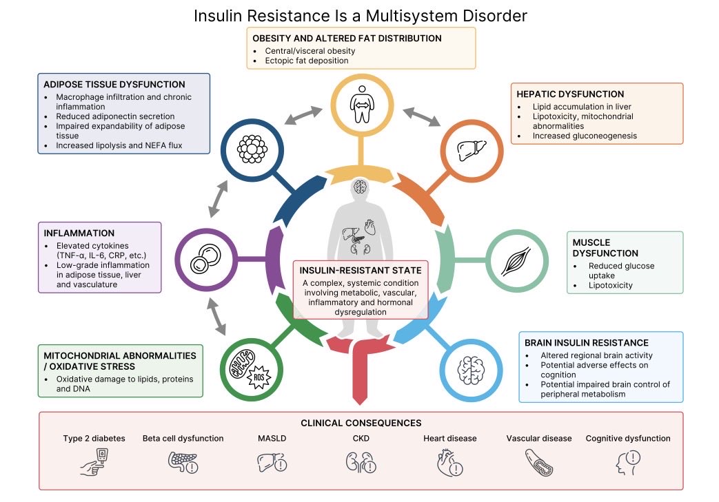 cristinatejerap's tweet photo. La resistencia a la insulina no es una entidad única. El Expert Forum de Diabetes, Diabetes Care y Diabetologia la redefine como un fenotipo dinámico, distinto según el tejido y la persona, y a veces adaptativo (ayuno, embarazo, ejercicio) 👇 @DiabetologiaJnl 

➡️ Lo que me llevo a consulta: HOMA-IR orienta, pero no mide, y el fenotipo clínico pesa más. Casi todos los fármacos mejoran la resistencia a la insulina de forma indirecta; el único sensibilizador real sigue siendo pioglitazona. Y el sueño y el ejercicio cuentan y mucho ! 

#EASD2026 

https://t.co/dprn6gMrhM