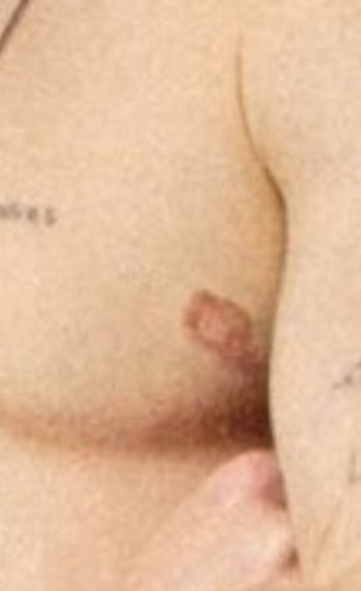 randalflaghc's tweet photo. @MJTruthUltra Worlds saddest nipple ☹️ https://t.co/PtcanZ4PTz