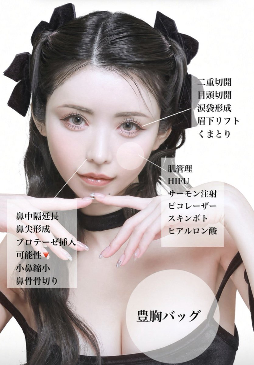 mtgjdpa's tweet photo. キャバ嬢の整形レシピで目は全切開＋目頭切開＋タレ目形成やって鼻は鼻骨骨切り＋小鼻縮小＋鼻中隔延長して皆んな似たり寄ったりの整形してるのに、人によってナチュラルに仕上がったり不自然に仕上がったりするのってオーダーの失敗なんだと思うよ。

ひびたんのバブみ化失敗とかまさにこれ。 https://t.co/GFD1b4T01c