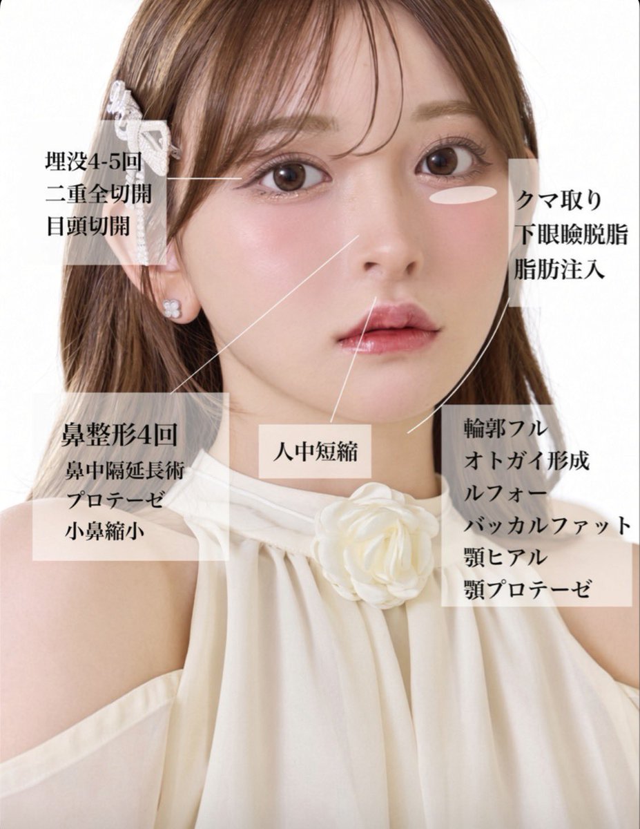 mtgjdpa's tweet photo. キャバ嬢の整形レシピで目は全切開＋目頭切開＋タレ目形成やって鼻は鼻骨骨切り＋小鼻縮小＋鼻中隔延長して皆んな似たり寄ったりの整形してるのに、人によってナチュラルに仕上がったり不自然に仕上がったりするのってオーダーの失敗なんだと思うよ。

ひびたんのバブみ化失敗とかまさにこれ。 https://t.co/GFD1b4T01c