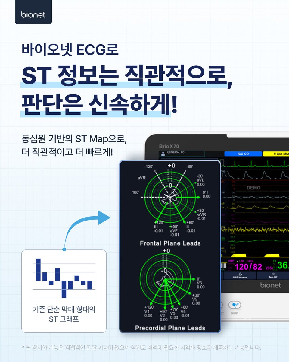 BionetHQ's tweet photo. ST 변화를 한눈에 🔍
바이오넷 ECG의 ST Map은 ST 상승·하강과 변화의 분포를 원형 맵으로 보여주어 의료진의 심전도 해석을 돕습니다.

미국 특허 US 11,553,868 B2

※ ST Map은 진단을 내리는 기능이 아닌 해석 보조 도구입니다.

#Bionet #STMap #ECG https://t.co/z96Cmd8StR