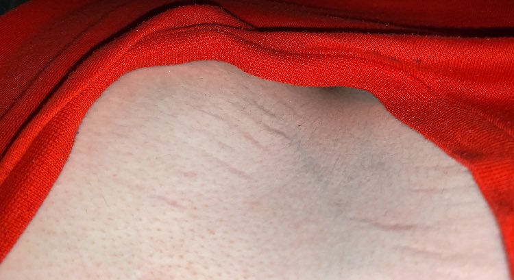 mockingstasis's tweet photo. i need to start wearing a bra more often why do i have stretch marks on my boobs https://t.co/N6LZ1RGPqw