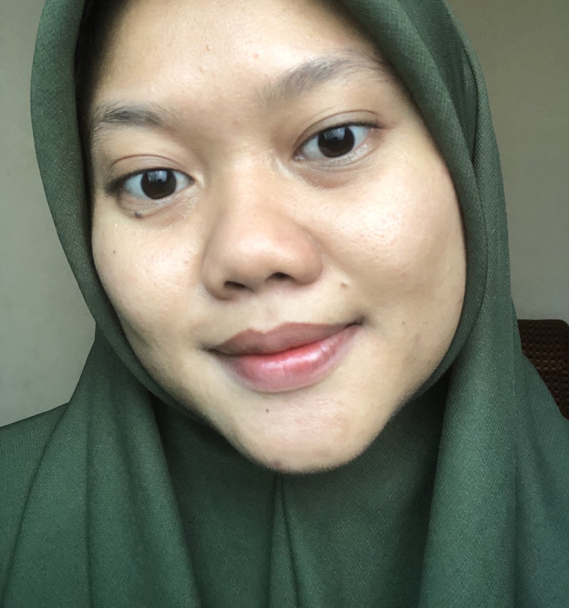 manaaaasi's tweet photo. dulu kalo ada jerawat 1 aja langsung insecure seharian😢

sekarang ngerti cara bikin si acne monster ini GAME OVER👋🏻 https://t.co/SAqhSn9mPA
