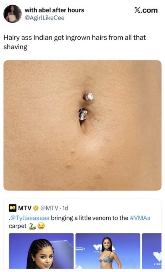 StanbaseX's tweet photo. I’d hate to be celebrity because https://t.co/JlgkJvhONJ