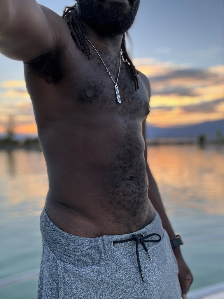 SmokyTheSwiss's tweet photo. #tummytuesday
Est-ce que quelqu’un veut bien me retirer le short ?
#chaser #hairy #goodboy https://t.co/ZFvOwknLc5