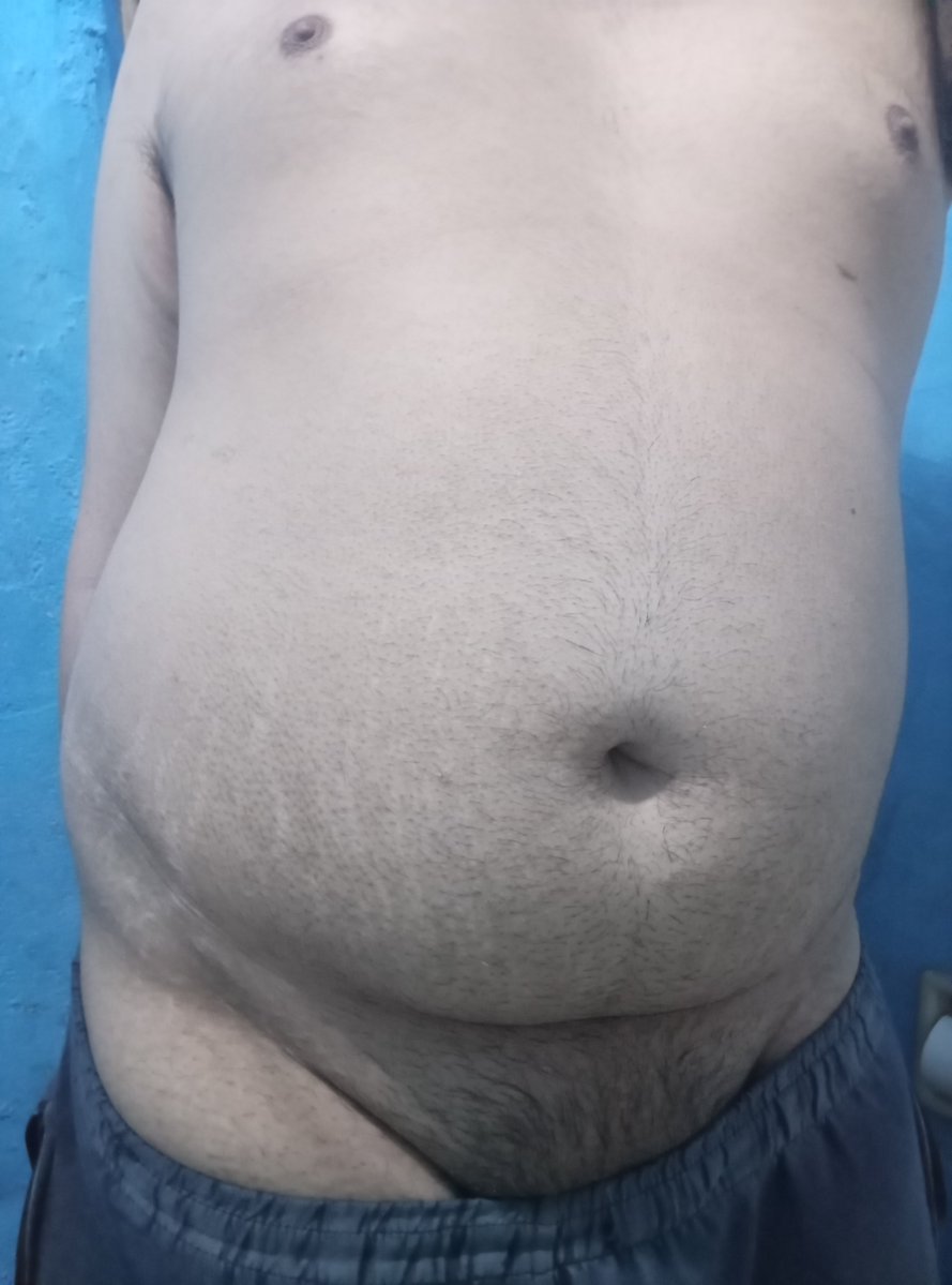 Lewd_malewitch's tweet photo. Tummy
#nsfwtwt #nsfw #gay #puppyboy https://t.co/XqVmHkaWSM