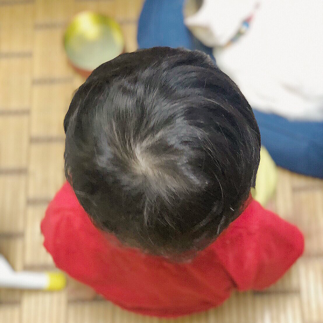 hina_maki_'s tweet photo. うちの長男のビフォーアフターでも見てください、本当にやって良かったよヘルメット矯正 https://t.co/bGIx5Zuu2l