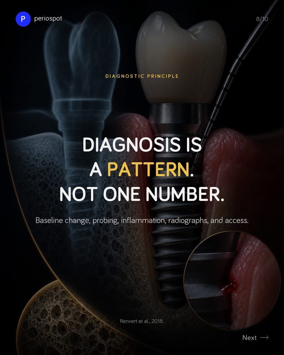 drAnasabdo's tweet photo. •Probing around implant,periimplant sounding.
•السبر حول الزرعات التي تحتوي تركيبات …كيف يتم حسابها ؟ 

Courtesy: Perio post:

#endo_prostho_ortho
#EPO
#DrABDO
•You can ask …!!

•follow me: https://t.co/Z4NydLwsqb