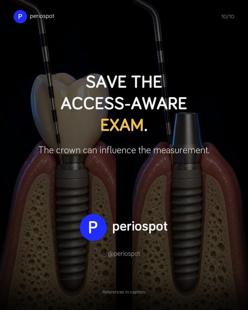 drAnasabdo's tweet photo. •Probing around implant,periimplant sounding.
•السبر حول الزرعات التي تحتوي تركيبات …كيف يتم حسابها ؟ 

Courtesy: Perio post:

#endo_prostho_ortho
#EPO
#DrABDO
•You can ask …!!

•follow me: https://t.co/Z4NydLwsqb