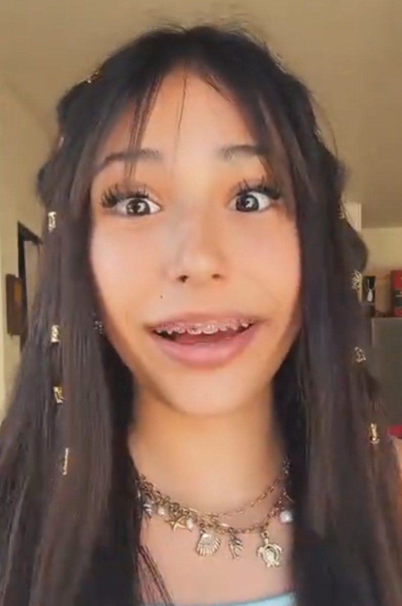 IvyisMyN1's tweet photo. I just know what triggers you already. Staring at her face and that metal mouth makes you sooo weak 😵‍💫 https://t.co/MyOnfoYev0
