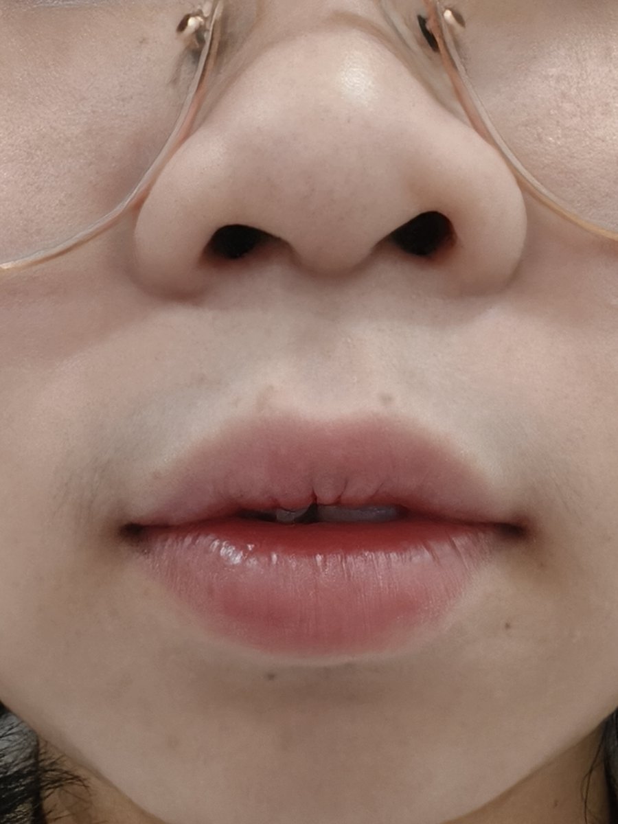 Boo_lunaa's tweet photo. อยากป้ายยาลิปบาล์มมีสีของนีเวีย 
สี blackberry🍇ʕ⁠·⁠ᴥ⁠·⁠ʔ กลิ่นหอม เนื้อมีความหนึบ แต่น้องยังเกลี่ยง่ายอยู่ สีสดชัดถึงจะเติมไปเรื่อยๆ นี่ว่าก็ไม่หนักปาก เราชอบชอบทาแบบน้องแบบค่อยๆ แตะๆ เกลี่ย ๆออกมาสีสวยเลย ในรูปก็ทาแบบนั้นแล้วทาน้อยเพราะอยากได้ความใสๆความฉ่ำ4/10 ความติดทน 6/10  ซึ่ง 1 แท่งใช้ได้นานมาก น้องเคยไวรัลช่วงนึงแถมตอนนี้สีนี้หายากแล้วด้วย คอนเฟิร์มว่าสีสวย เหมาะพกพาไปเติมระหว่างวันได้ทุกที่เลย🫶🏻✨
🛒:https://t.co/7SFubh4IHo
#ลิปนีเวีย #ป้ายยา #Shopeeafflilate