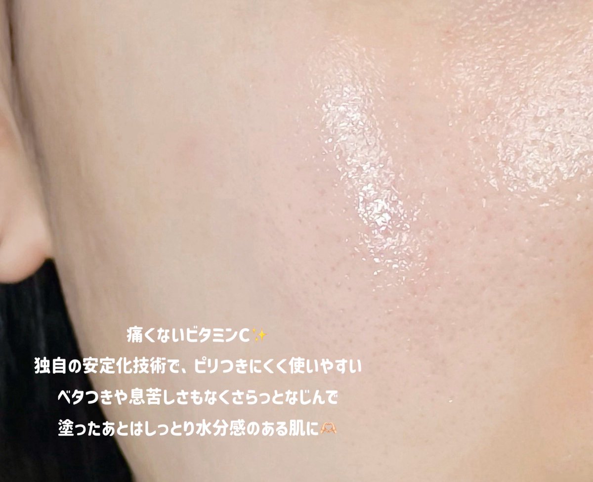 敏感肌でも刺激ないビタミンC探してる人におすすめなのがこれ。
AriulのビタミンCはビタミンCにありがちなピリつきがないし油分感少ないところがかなり好み！
アンプルはビタミンC14%のアンプル、99%水分ベースのクリームで皮脂多いけど乾燥でつっぱりやすいインナードライにもぴったりです👇🏻👇🏻(PR) https://t.co/pYNujz6KrX