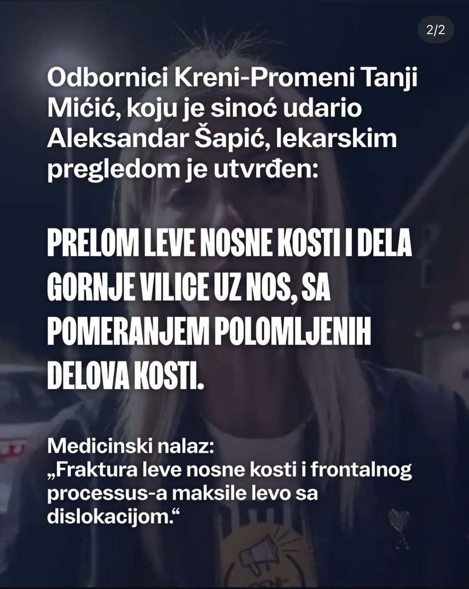 Stamena998's tweet photo. A kako je doticna pricala ako joj je slomljena vilica????
Jeftina režija i loša gluma sorryyyy https://t.co/wI7ukLjS9a